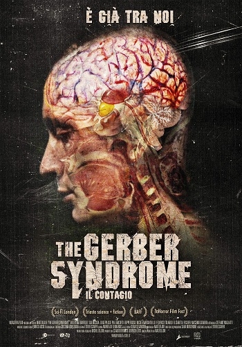   / The Gerber Syndrome: il contagio VO