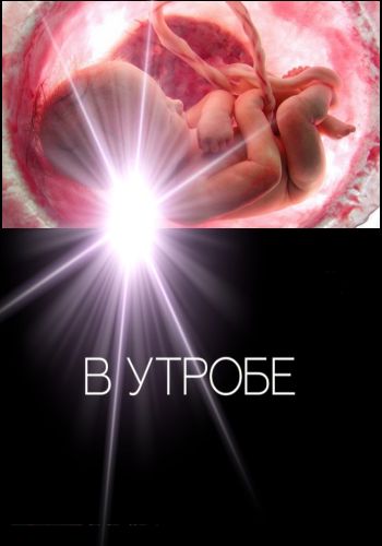   / In Utero DVO