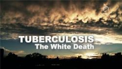  -   / Tuberulosis: The White Death VO