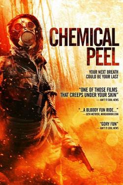   / Chemical Peel MVO